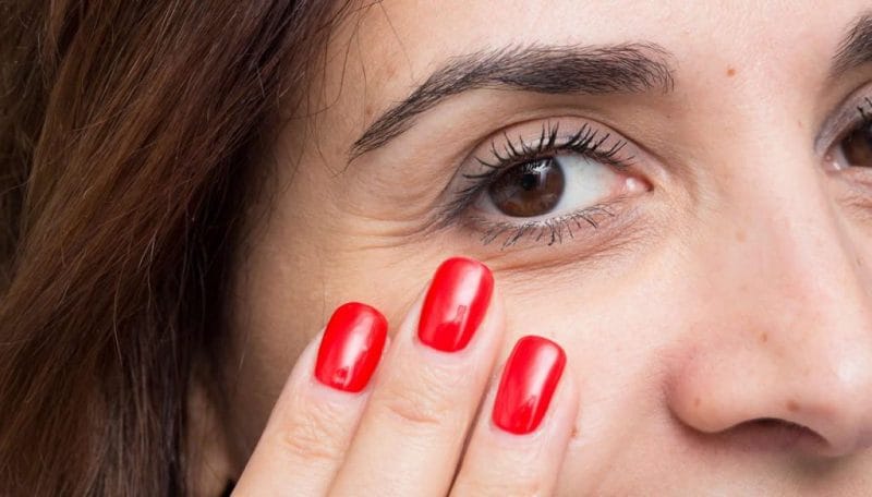 plasma eye lift