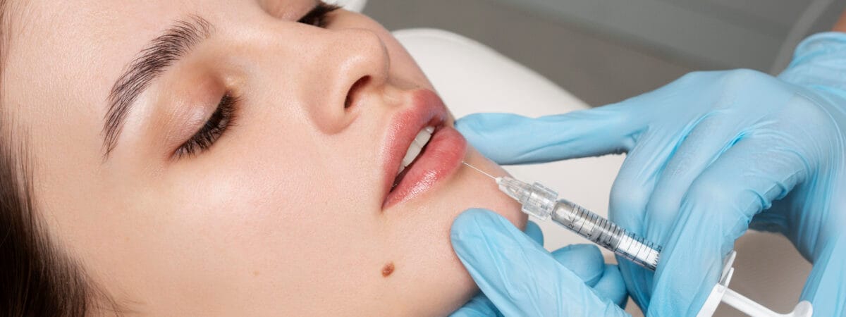 how long do lip fillers last