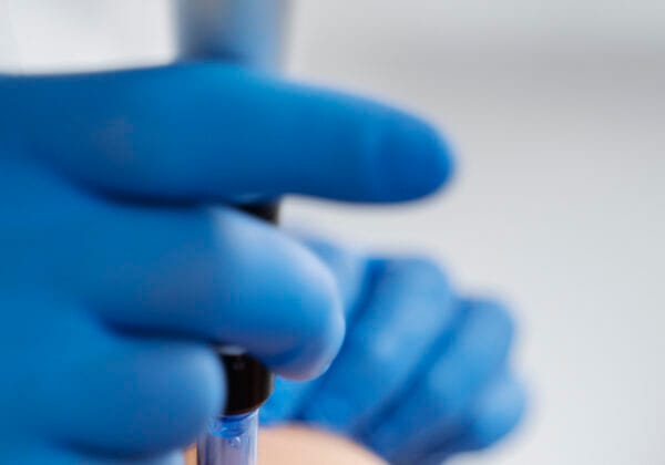 Does Microneedling Hurt?