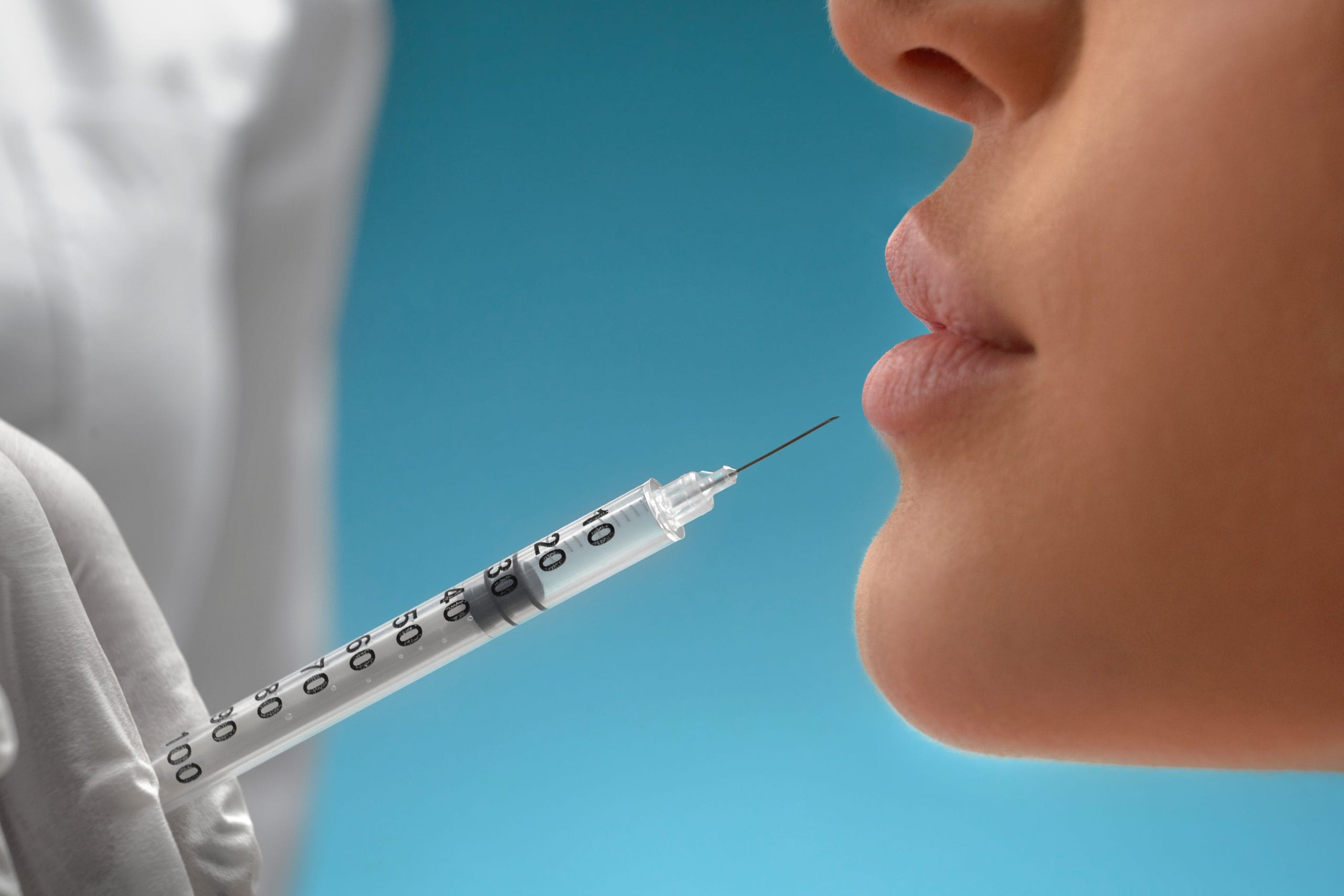 Lip filler treatment at Immaculate Touch